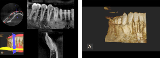 歯科用ＣＴ（コンピュータ断層撮影装置） / ３Ｄパノラマレントゲン