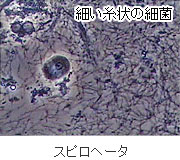 歯周病の原因：細菌 − スピロヘータ