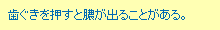 歯ぐきを押すと膿が出ることがある。